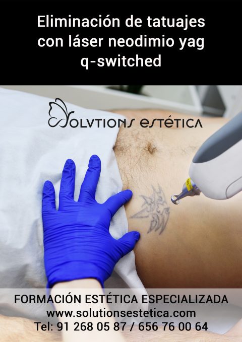 eliminacion_tatuajes